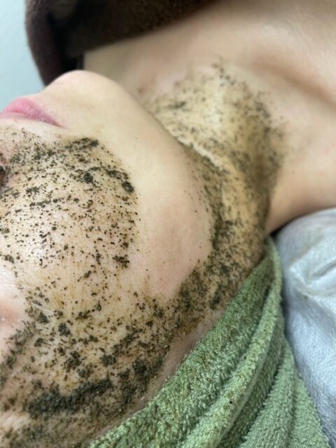 ハーブピーリング